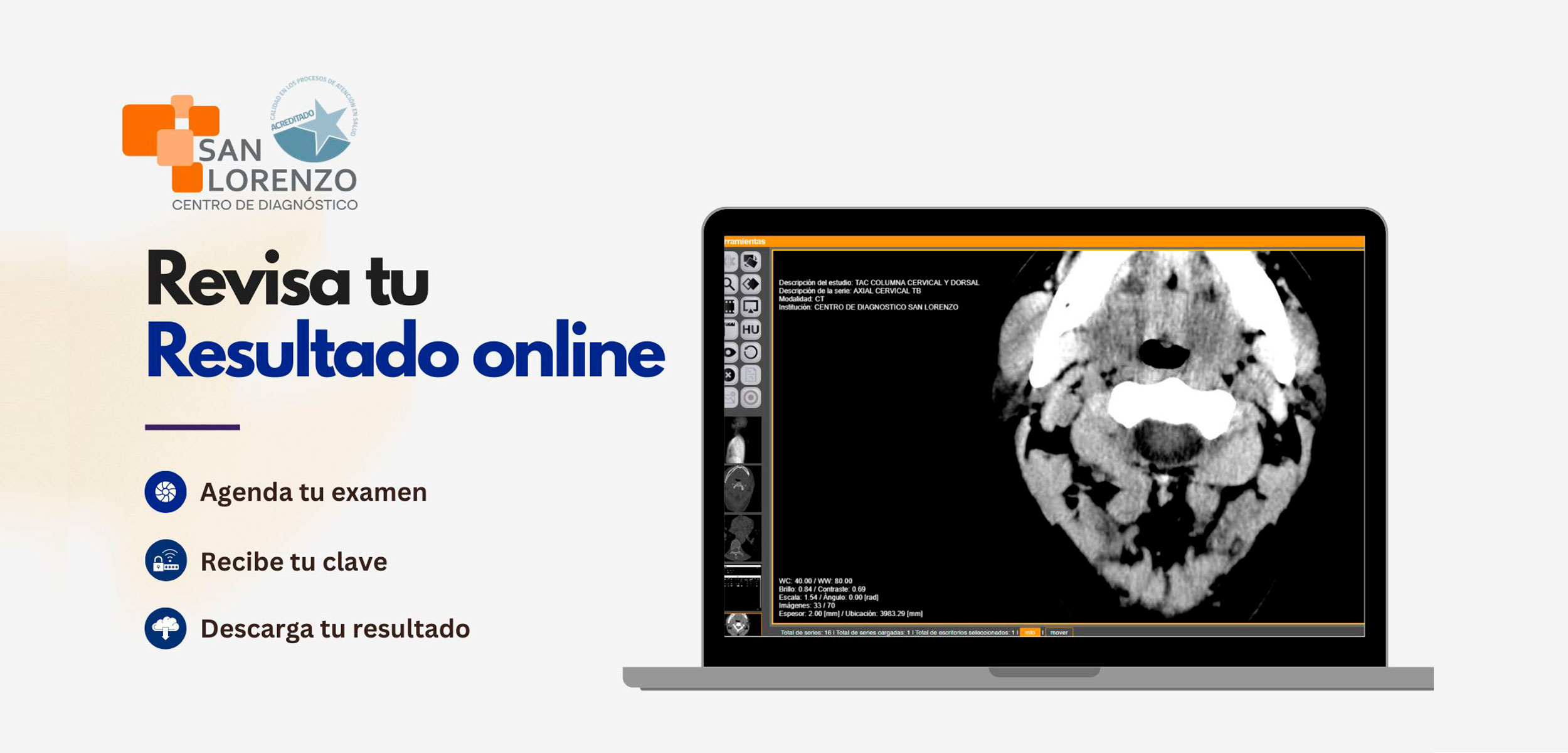 Diagnóstico por imágenes San Lorenzo